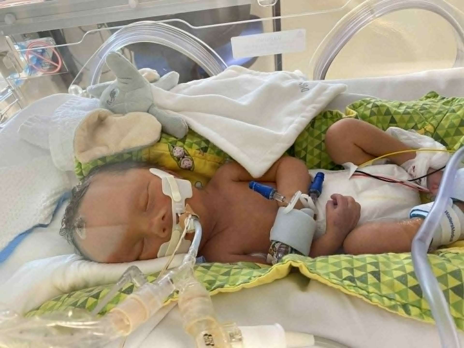 Noah resting with Dumbo in the incubator